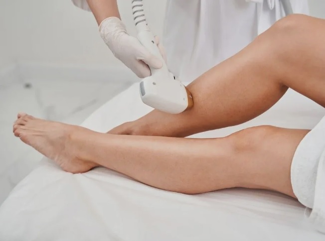 Laser Hair Removal Coventry