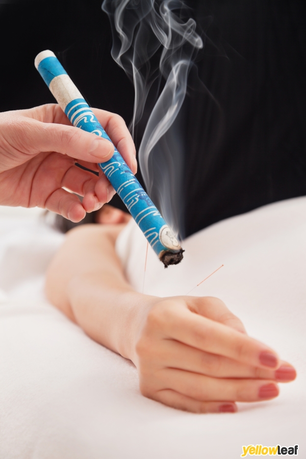 Mark Arnold Acupuncture