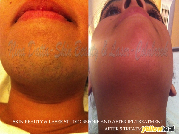 Skin Beauty & Laser Studio