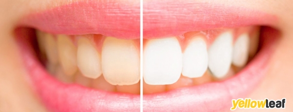 Zenith Dental Clinic