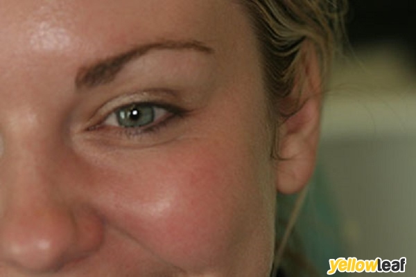 Advanced Facial Rejuvenation Clinic