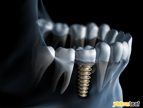 New Eltham Dental Practice and Implants Centre
