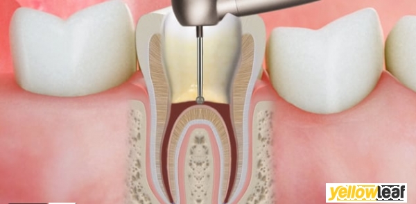 Dental On The Banks