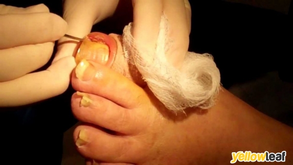 Pittodrie Podiatry Practice