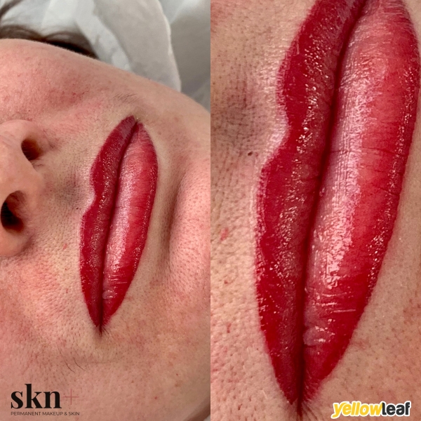 Skn Plus Cosmetic Clinic