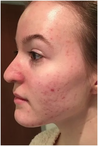 Helen Cleland Non Surgical Aesthetic Procedures