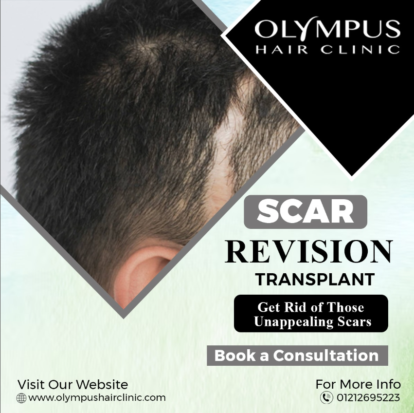 Olympus Hair clinic