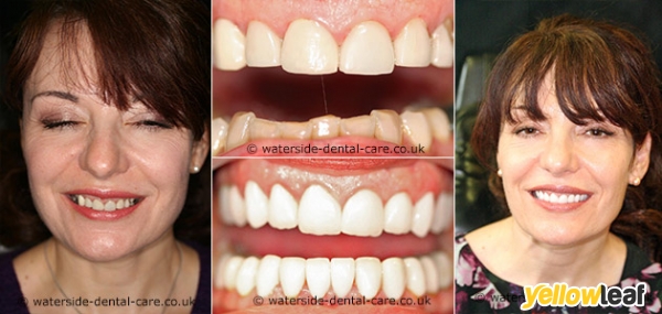 Waterside Dental Care
