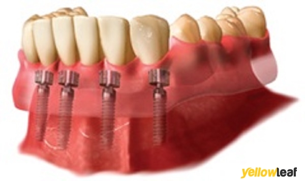 Glasgow Denture Studio