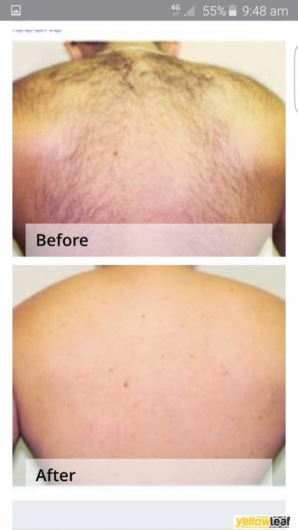 Clear skin laser Ltd