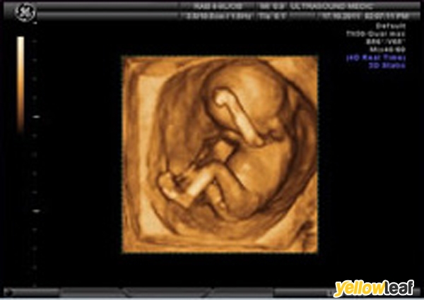 Private Ultrasound Ltd