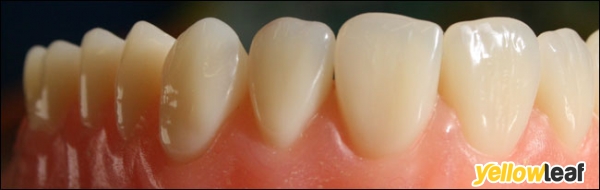 Birches Head Denture Clinic