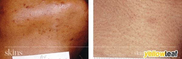Skins Clinic