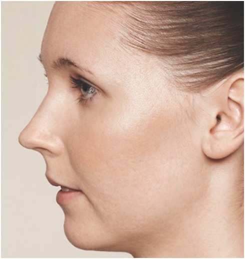 Helen Cleland Non Surgical Aesthetic Procedures