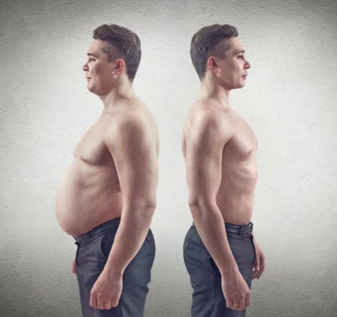 Vaser Lipo Centre