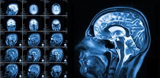 MRI Plus
