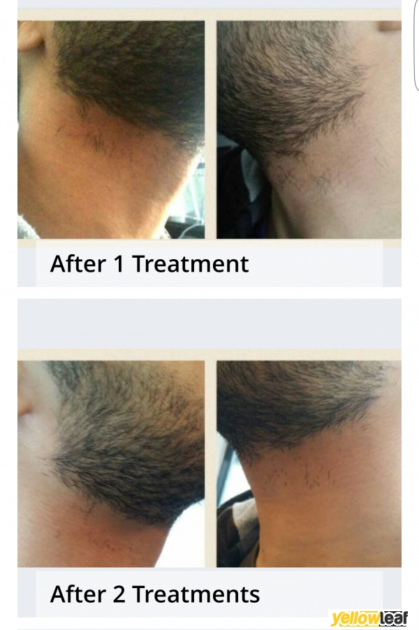 Clear skin laser Ltd