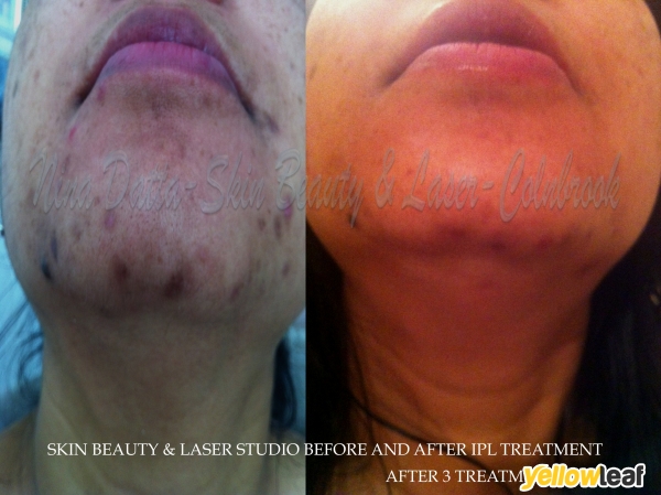 Skin Beauty & Laser Studio