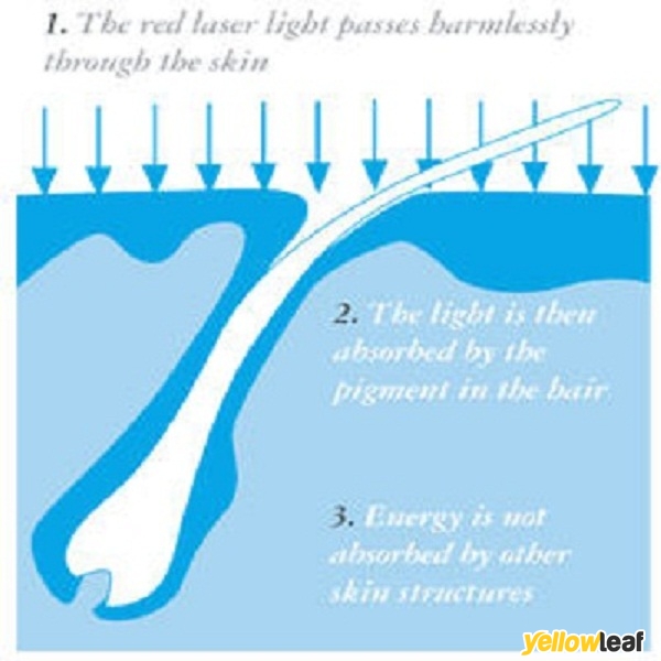 Complete Lasercare