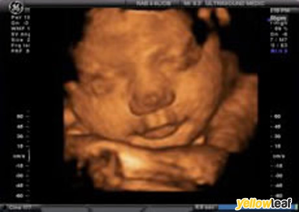 Private Ultrasound Ltd