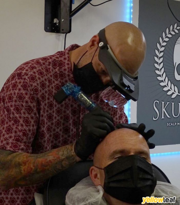 Scalp Micro Pigmentation by Skulltec