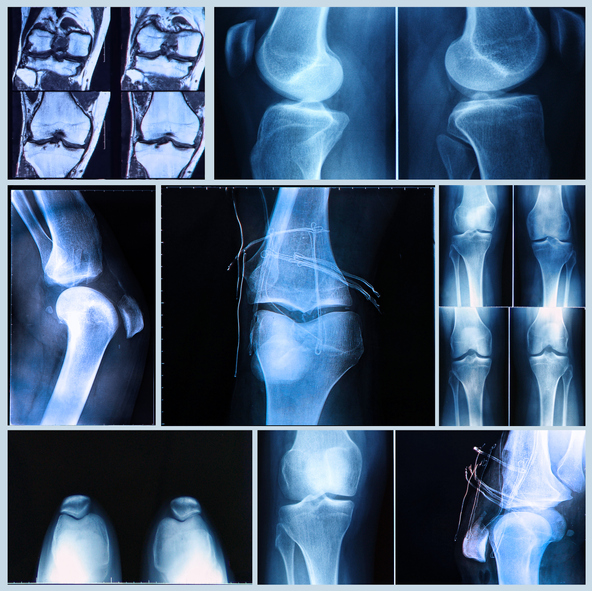 MRI Plus