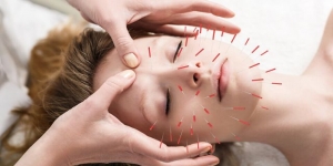 Lu Zhao Acupuncture