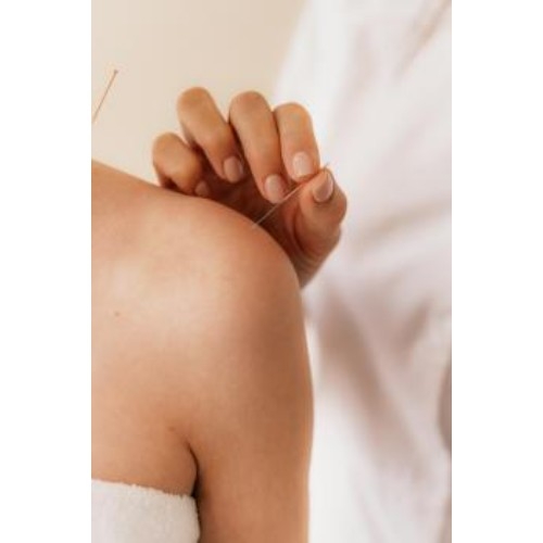 Wild Acupuncture
